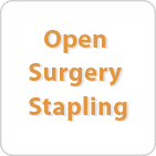 Open Surgery Stapling